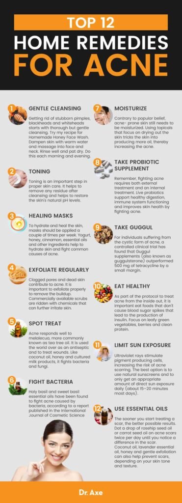 10 Effective Ways to Treat Acne