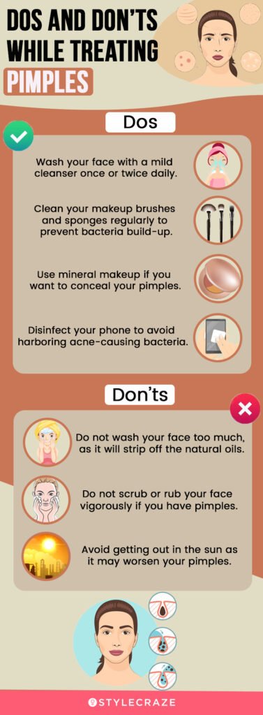 10 Effective Ways to Treat Acne