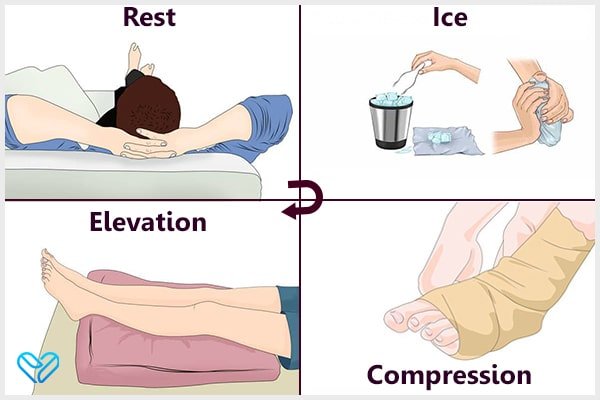 7 Natural Remedies for Leg Cramps