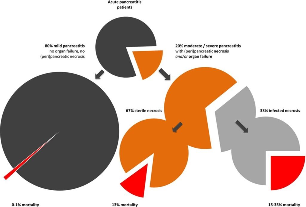 Acute Pancreatitis in the Modern Era: Advancements in Diagnosis and Treatment