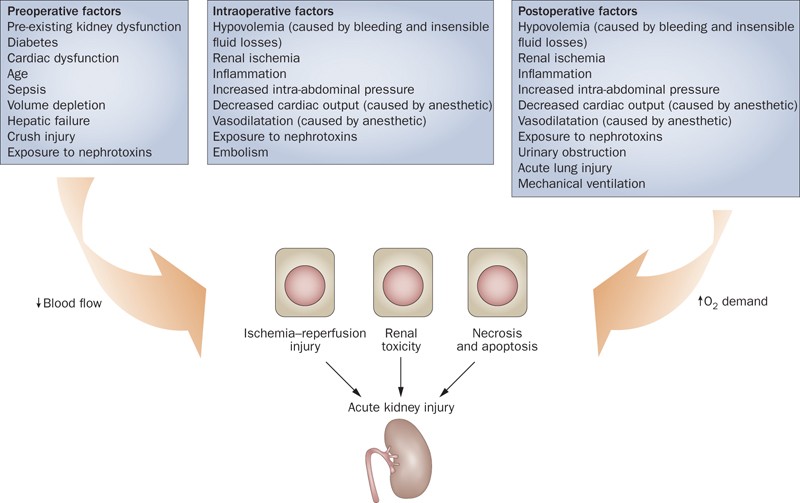 Acute Renal Failure in Elderly Patients: Recognizing Risks and Challenges