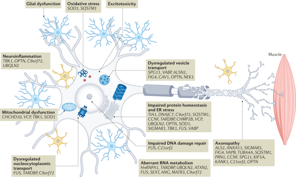 Advances in Research: Promising Breakthroughs in Motor Neurone Disease