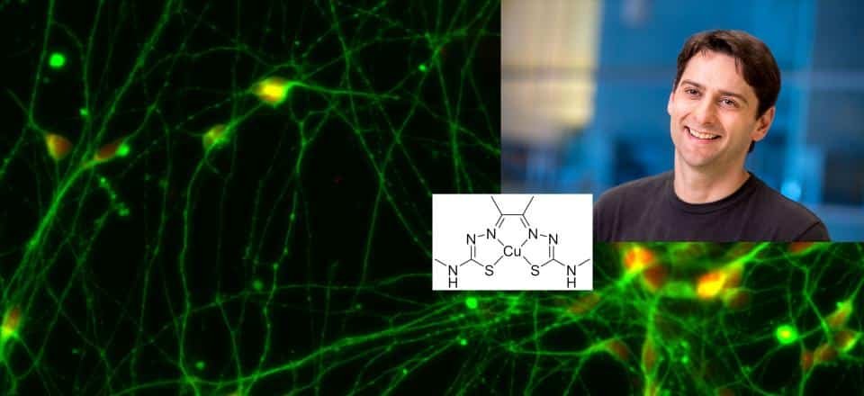 Advances in Research: Promising Breakthroughs in Motor Neurone Disease