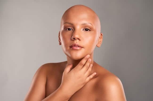 Alopecia Awareness: Breaking the Stigma