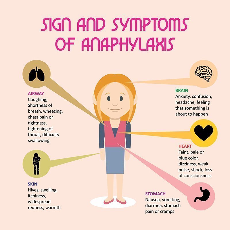 Anaphylaxis Triggers: Know Your Risks