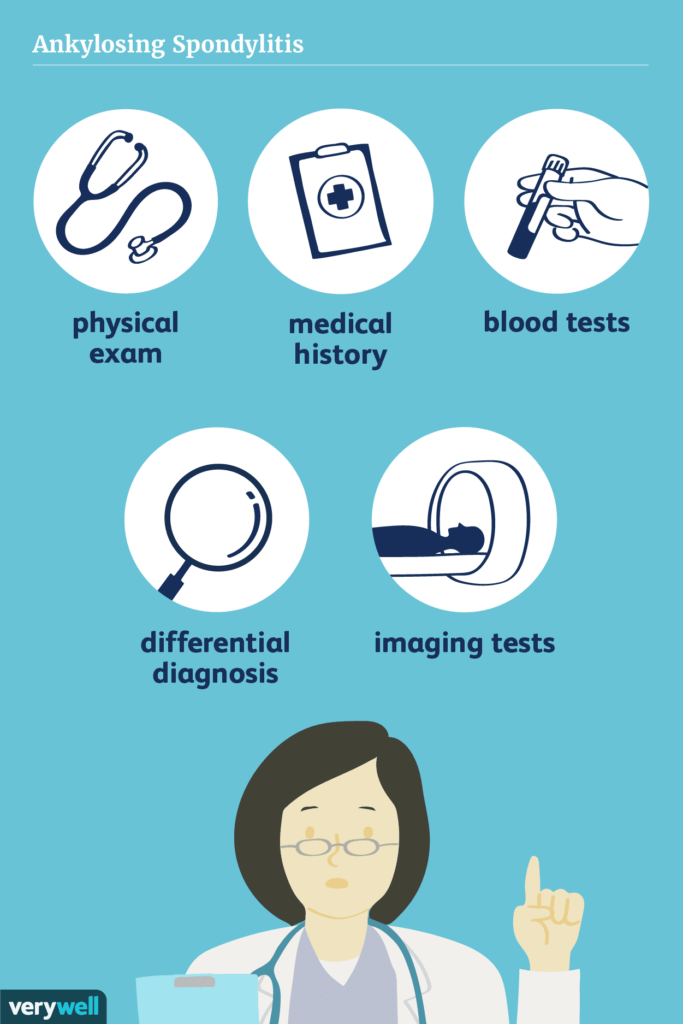 Ankylosing Spondylitis: Diagnosis and Early Intervention