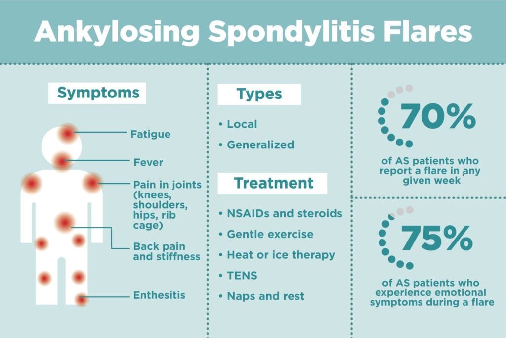 Ankylosing Spondylitis: Diagnosis and Early Intervention