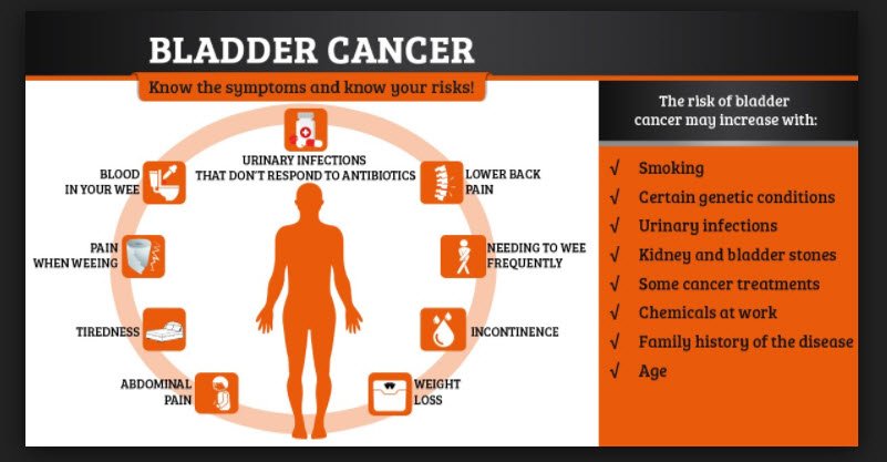 Bladder Cancer Causes and Risk Factors