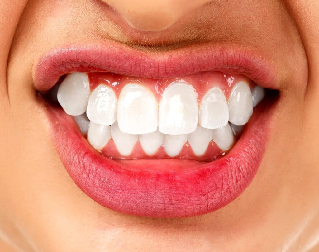 Bruxism and its Impact on Dental Health