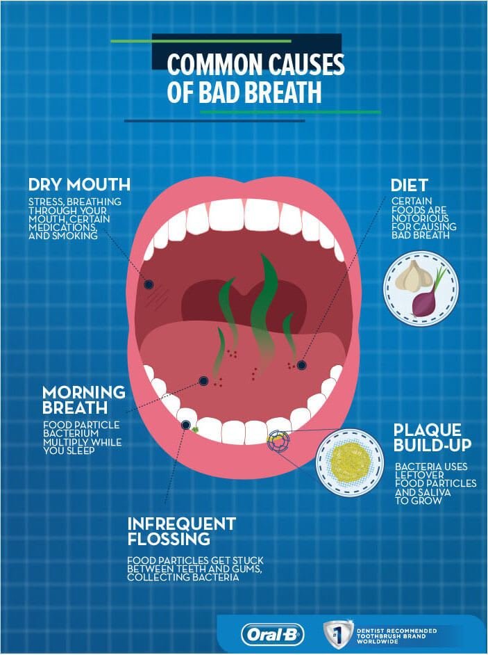 Causes and Treatment for Bad Breath