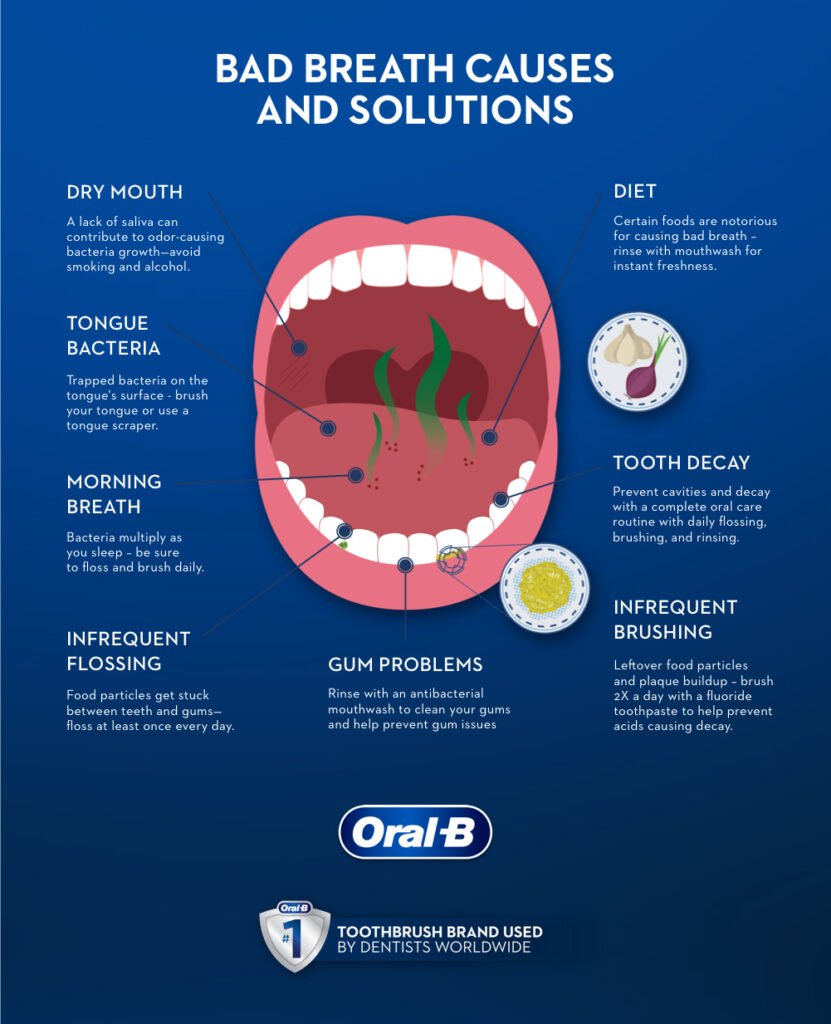 Causes and Treatment for Bad Breath
