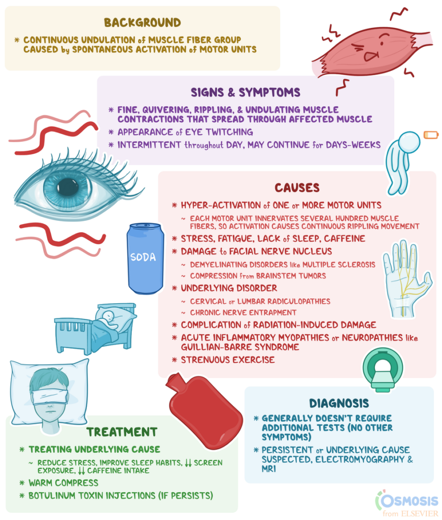 Causes and Treatment for Eye Twitching