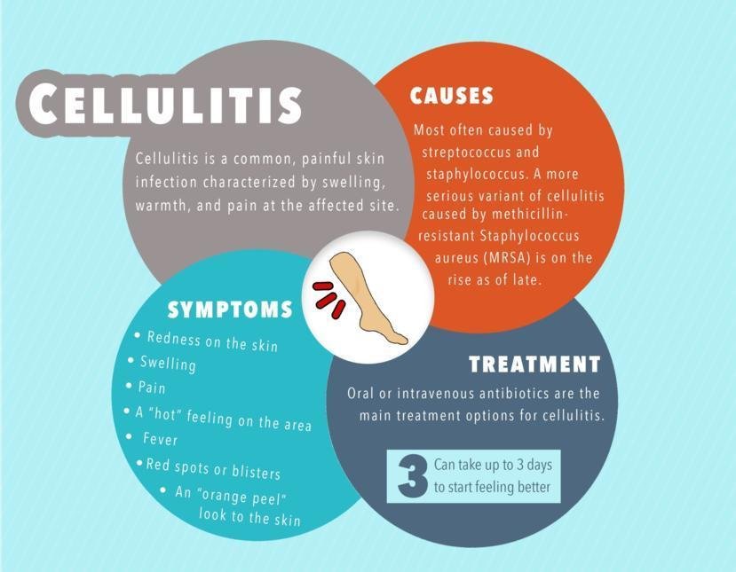 Cellulitis Complications: When to Seek Medical Attention
