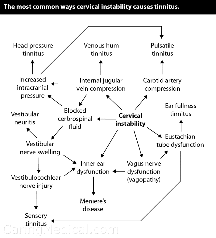 Cervical Tinnitus Treatment