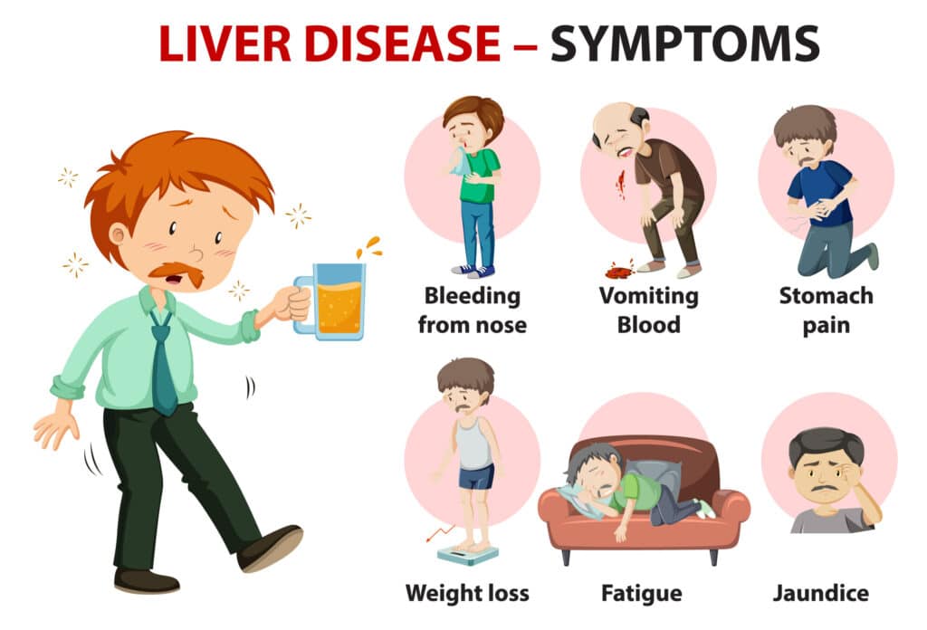 Common Symptoms of Liver Disease Common Symptoms of Liver Disease
