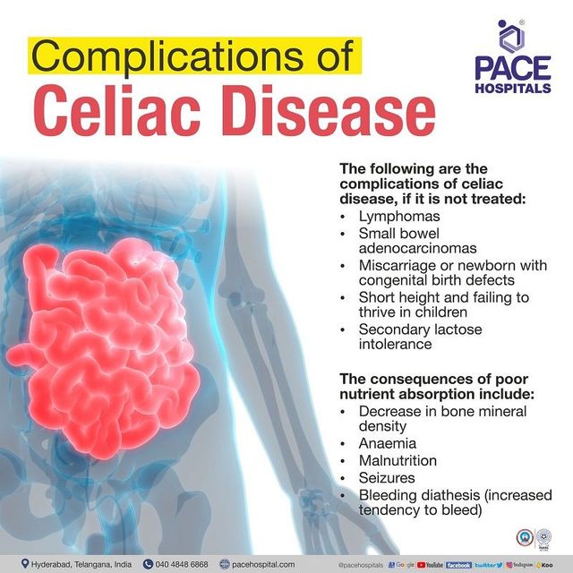 Complications of Celiac Disease Complications of Celiac Disease