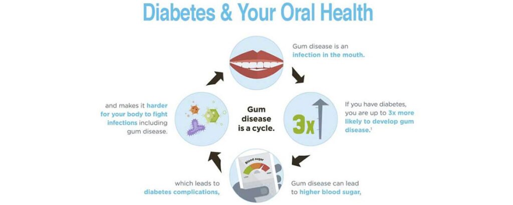 Diabetes Mellitus and Dental Health