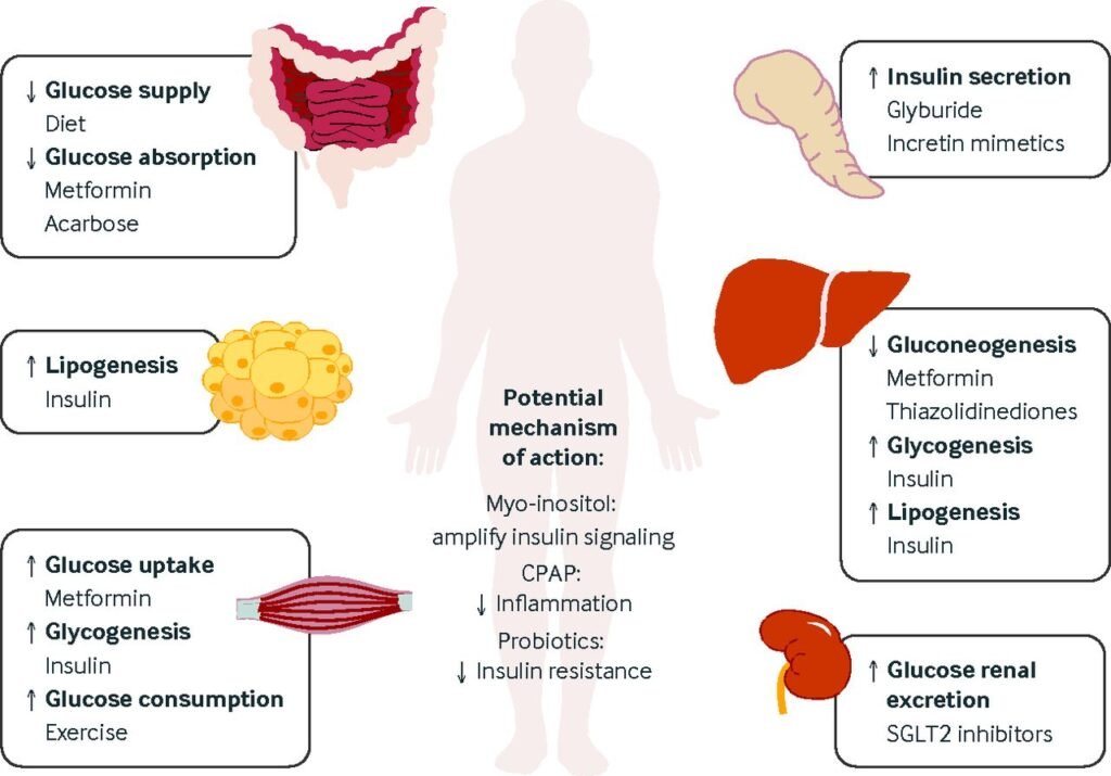 Diabetes Mellitus and Pregnancy