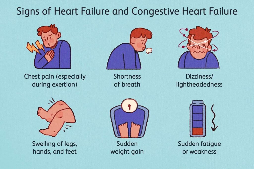 Diagnosing Congestive Heart Failure