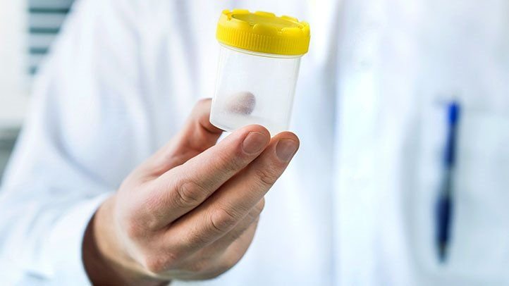 Diagnosing Kidney Infection: Tests and Procedures