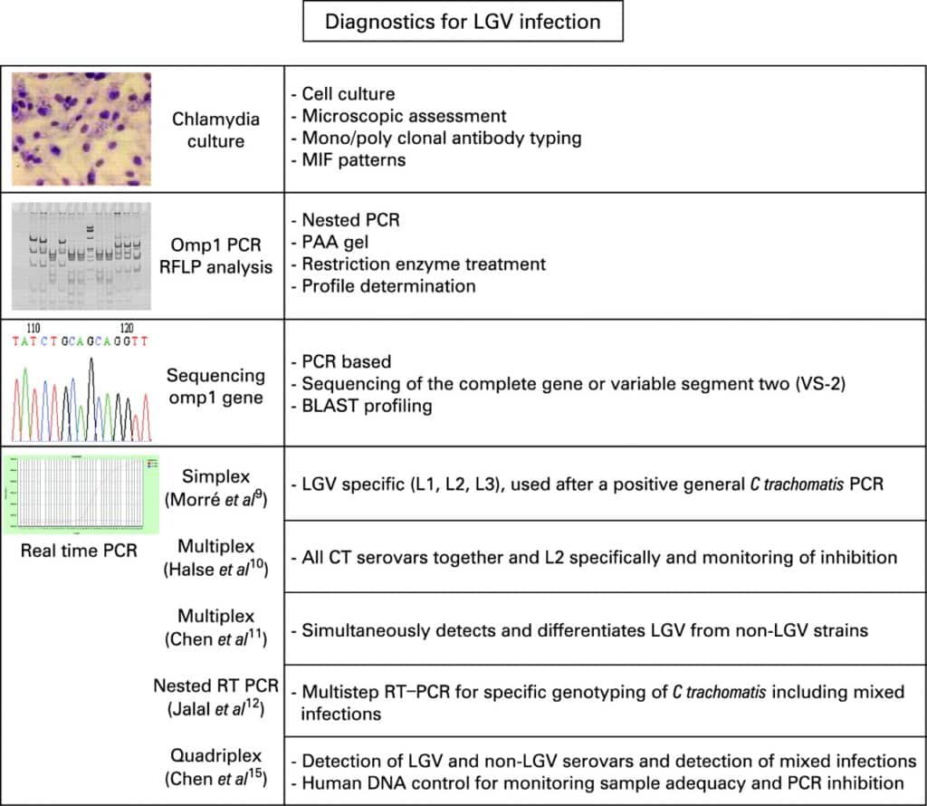 Diagnosing Lymphogranuloma Venereum (LGV)