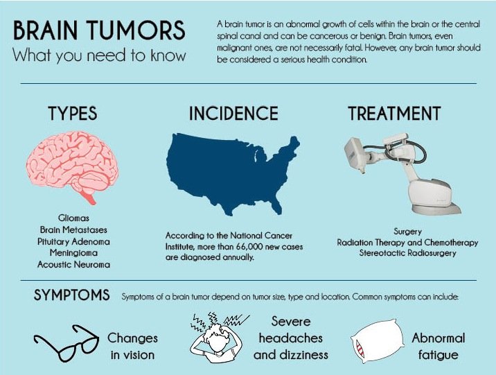 Diagnosis and Treatment of Brain Tumors