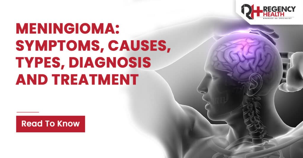 Diagnosis and Treatment of Meningioma
