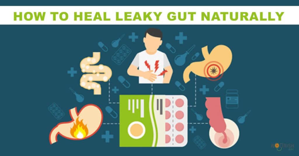 Dietary Strategies for Healing Leaky Gut Syndrome