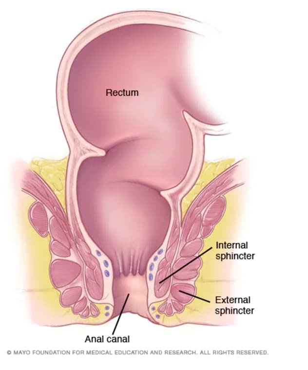 Early Detection of Anal Cancer: Key Signs to Watch For