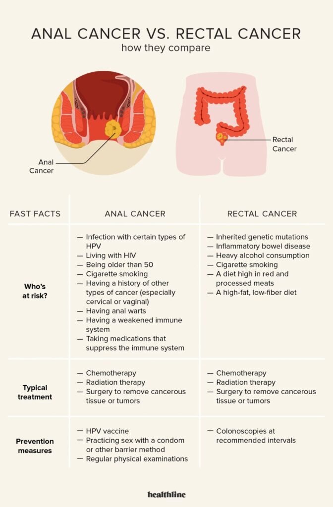 Early Detection of Anal Cancer: Key Signs to Watch For