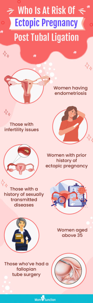 Ectopic Pregnancy Complications: Risks and Precautions Ectopic Pregnancy Complications: Risks and Precautions