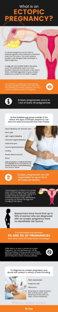 Ectopic Pregnancy Complications: Risks and Precautions Ectopic Pregnancy Complications: Risks and Precautions