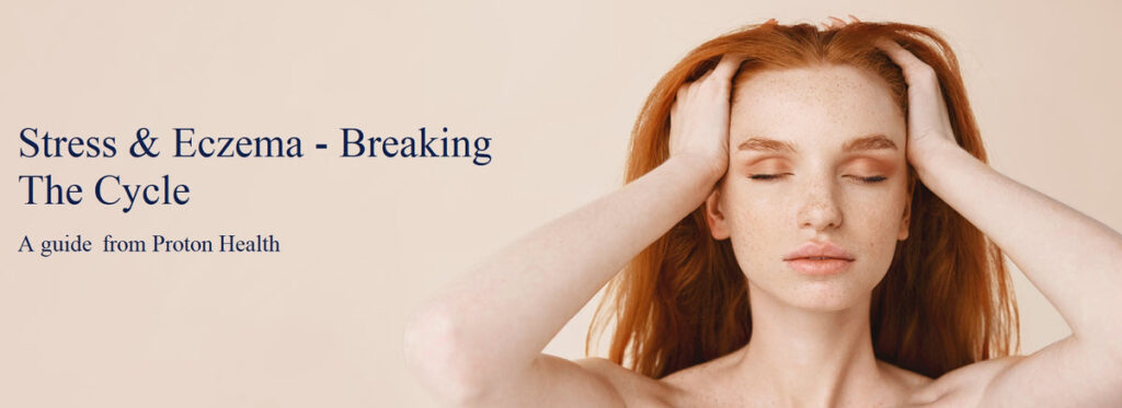 Eczema and Stress: Breaking the Cycle Eczema and Stress: Breaking the Cycle