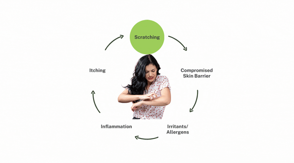 Eczema and Stress: Breaking the Cycle Eczema and Stress: Breaking the Cycle