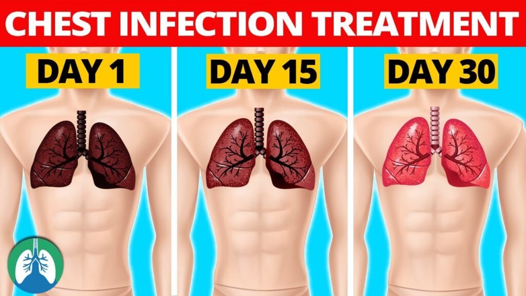 Effective Home Remedies for Chest Infections