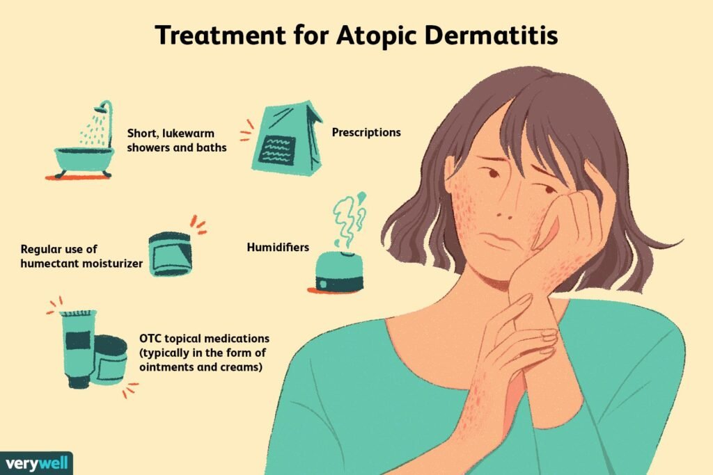 Effective Management Strategies for Atopic Eczema