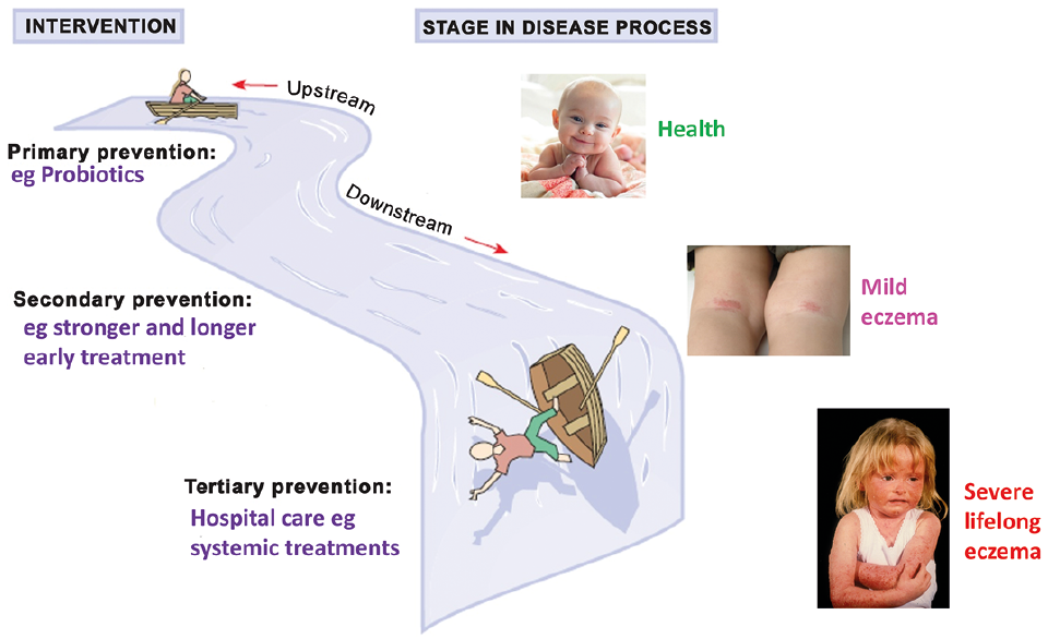 Effective Management Strategies for Atopic Eczema