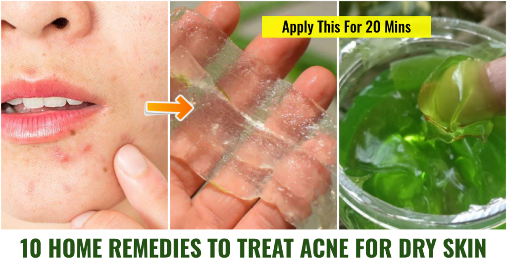 Effective Remedies for Dry Skin