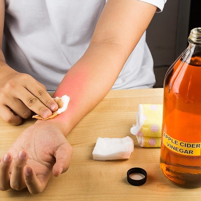 Effective Remedies for Warts