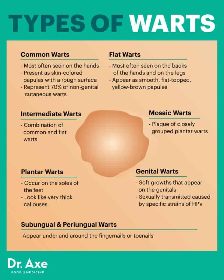 Effective Remedies for Warts