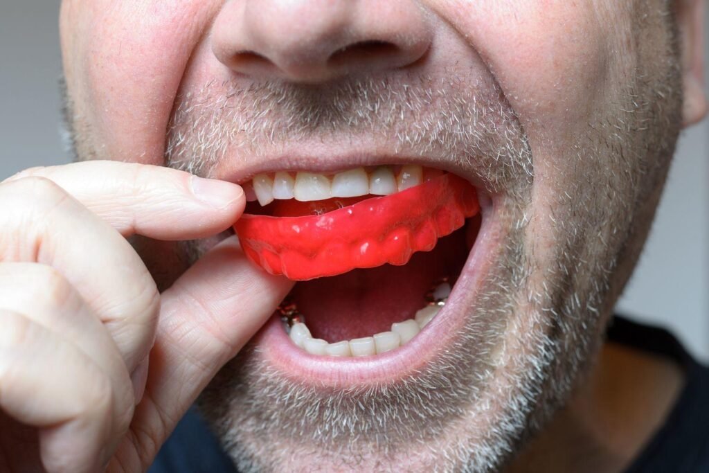 Effective Strategies to Manage Bruxism