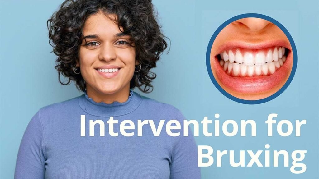 Effective Strategies to Manage Bruxism