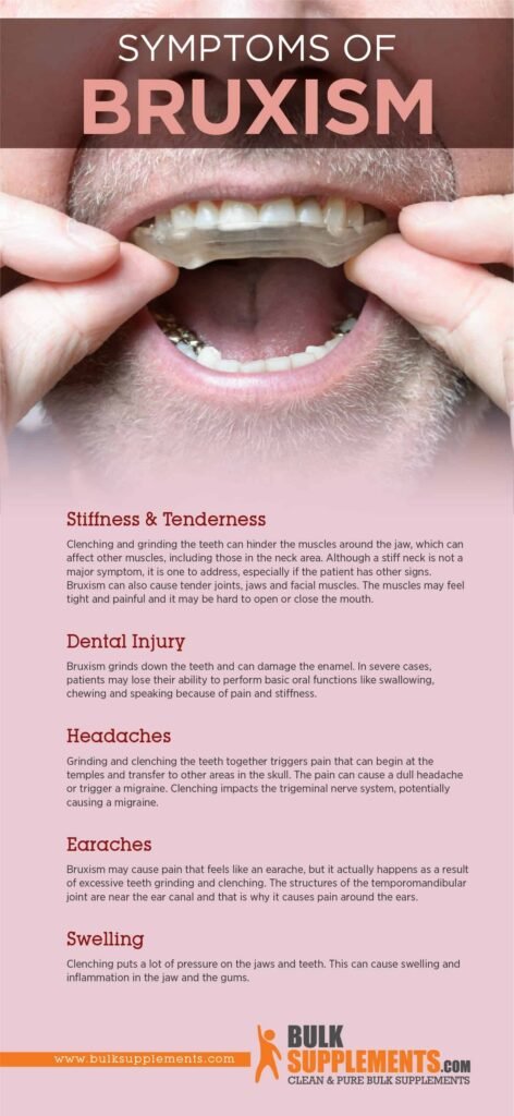 Effective Strategies to Manage Bruxism