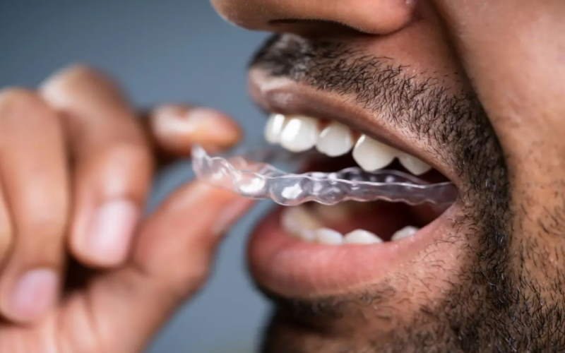 Effective Strategies to Manage Bruxism