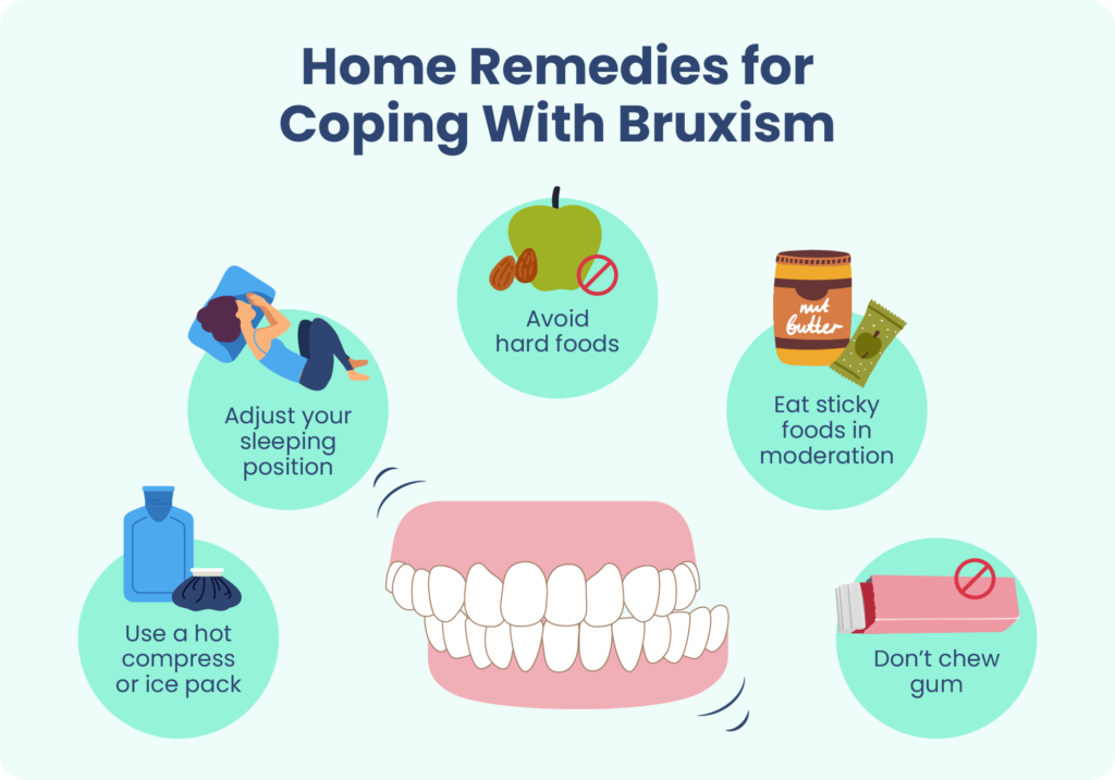 Effective Strategies to Manage Bruxism