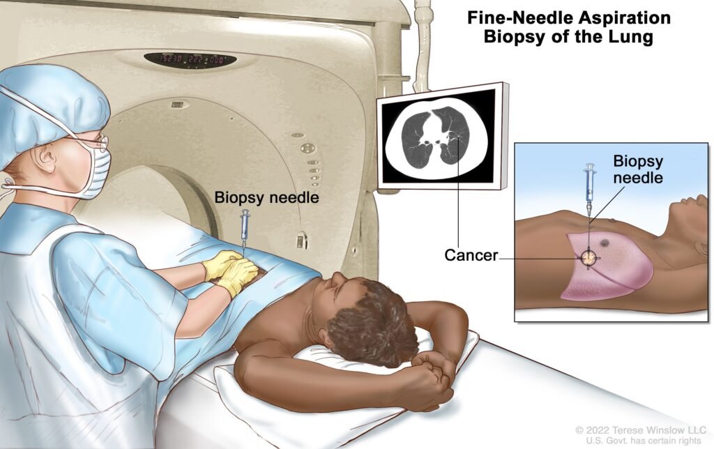 Effective Treatment Options for Asbestos Cancer