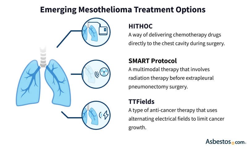 Effective Treatment Options for Asbestos Cancer
