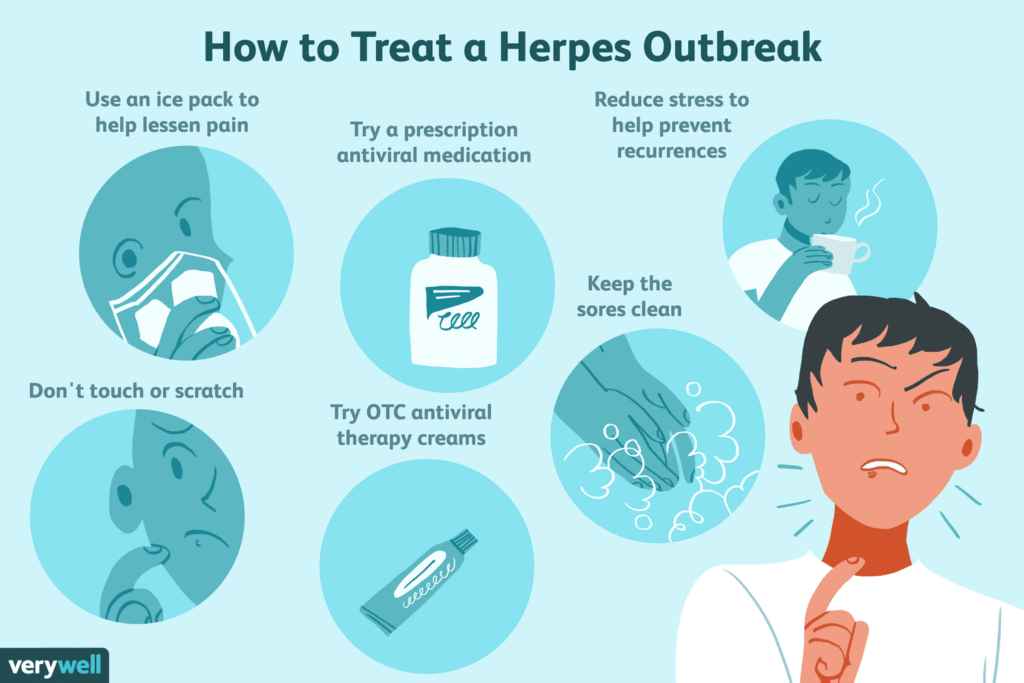 Effective Treatment Options for Cold Sores