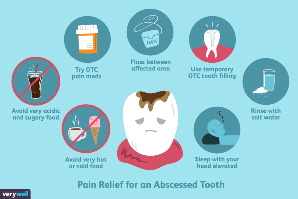 Effective Treatments for Dental Abscesses Effective Treatments for Dental Abscesses