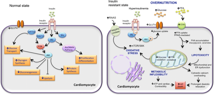 Effects of Insulin Resistance on Heart Health